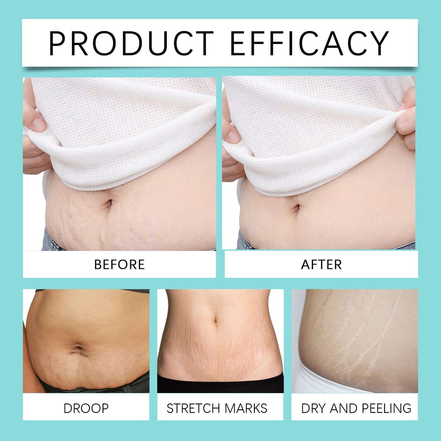 Hoygi Pregnancy Care Oil Postpartum Scars, Pregnancy Marks, Stretch Marks Repair, Nourishing, Smoothing Skin Body Care Oil