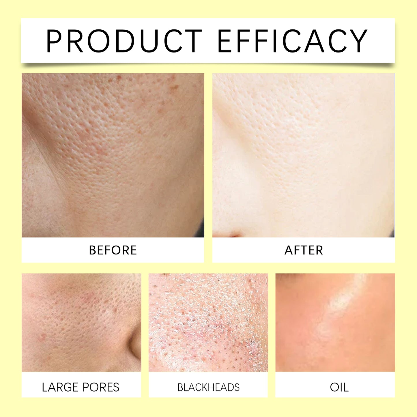 Jaysuing Turmeric Kojic Acid Cleansing Pad Gentle Cleansing Facial Skin Pore Lightening Acne Spots Cleansing Pad